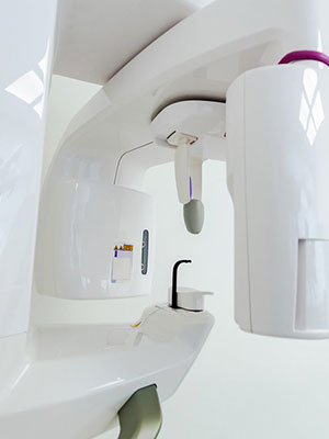 cbct referral